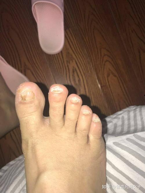 修灰指甲视频,轻松掌握修护灰指甲的实用技巧