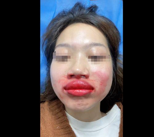 我嘴唇视频,我的嘴唇视频概述