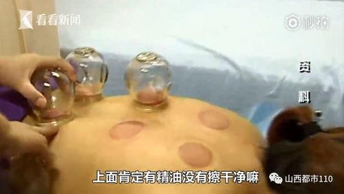 拔火罐的视频,传统中医养生秘技大揭秘
